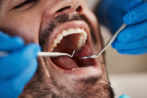Best Dentist for Tooth Abscess  in Lock Haven, PA